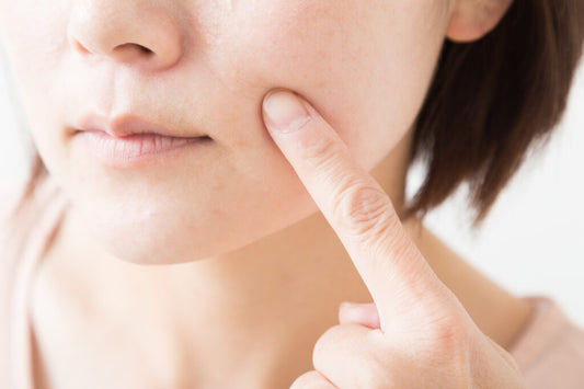 保湿が足りないと毛穴が開く?保湿がなによりも大切なワケ
